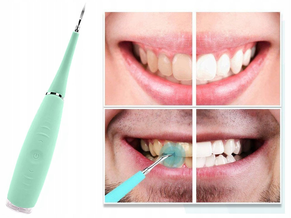 Portable Electric Sonic Dental Scaler